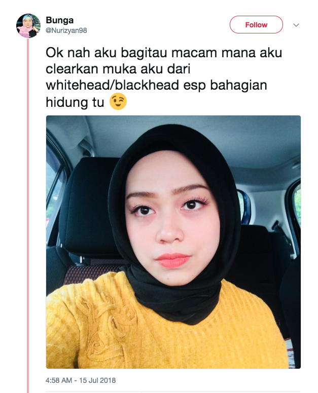 Rimas White/Blackhead Pada Wajah? Apa Kata Anda Amalkan Petua Gadis