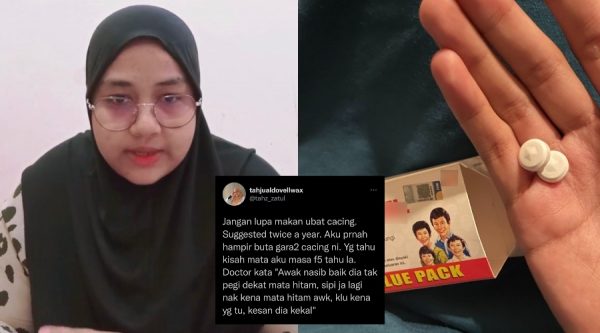 "Jangan Lupa Makan Ubat Cacing," Wanita Ini Nyaris Buta, Ada Cacing