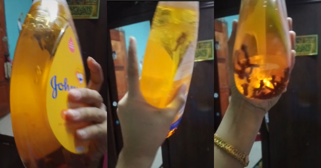 masalah rambut gugur