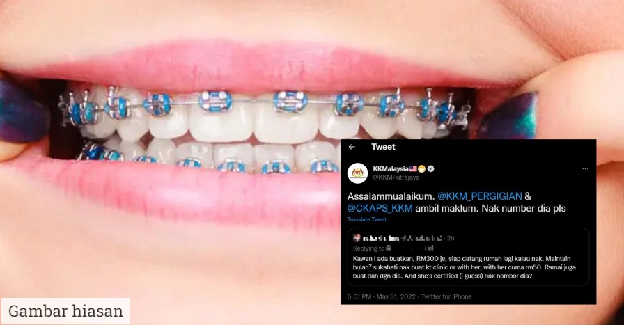braces murah