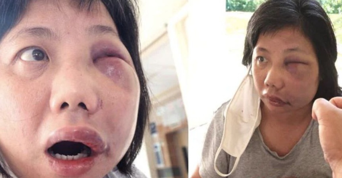 tumbuk muka wanita 5 kali