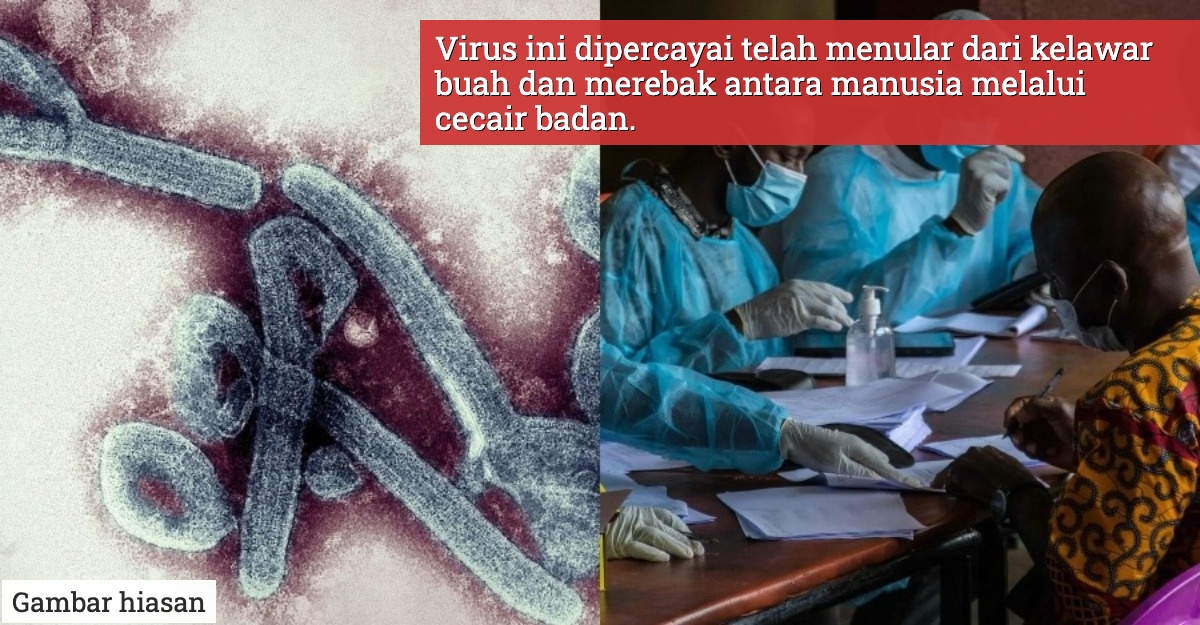 kes pertama virus Marburg