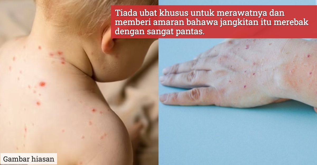 selesema tomato kini menular di India