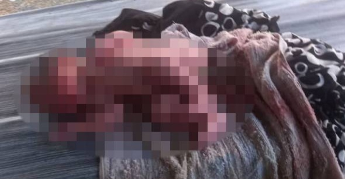 Bayi Lelaki Baru Lahir & Masih Bertali Pusat Ditemui