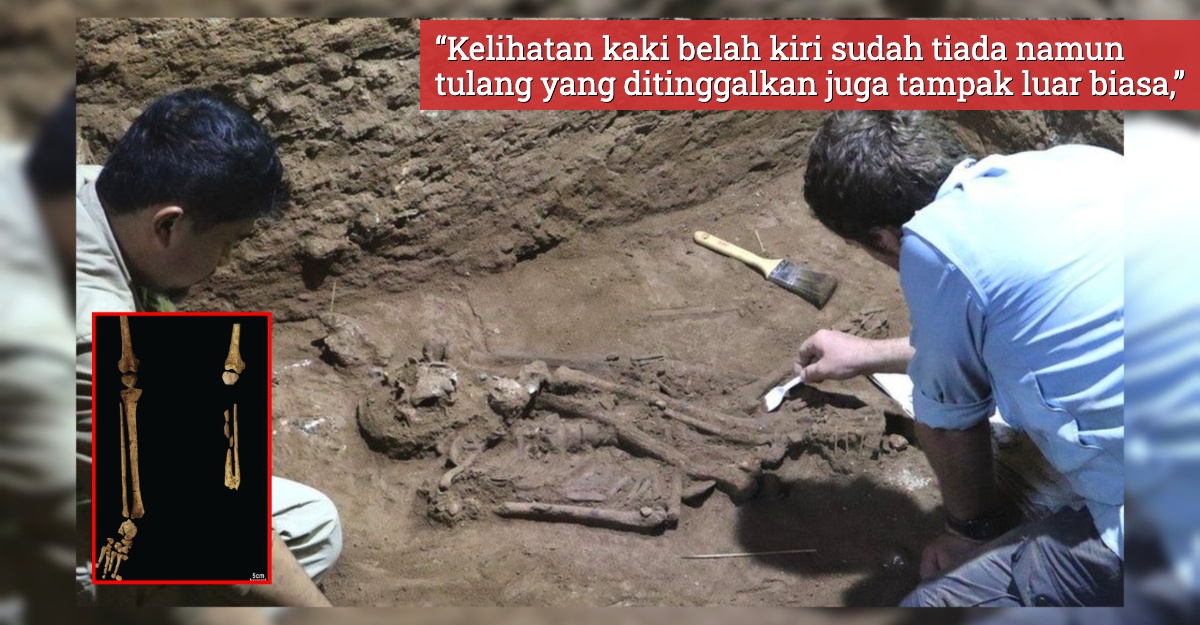 amputasi awal indonesia