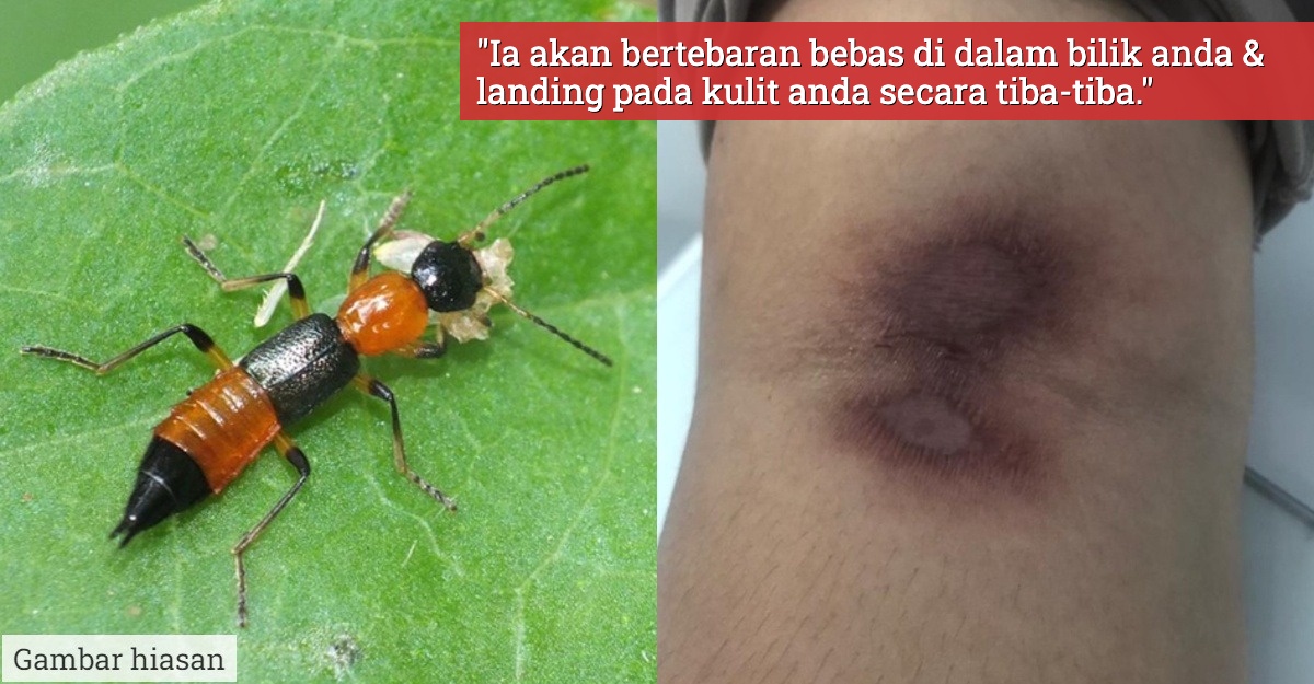 bahaya charlie