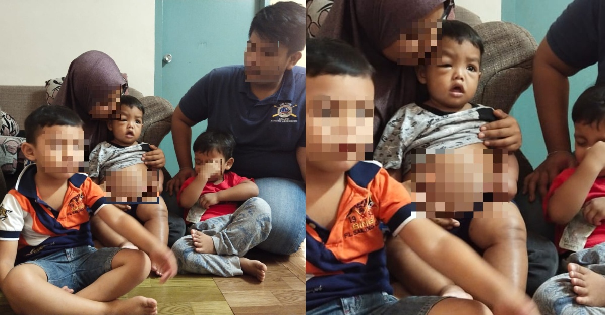 bayi buah pinggang bocor