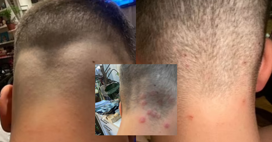Naik Kurap Lepas Gunting Rambut Di "Barbershop"