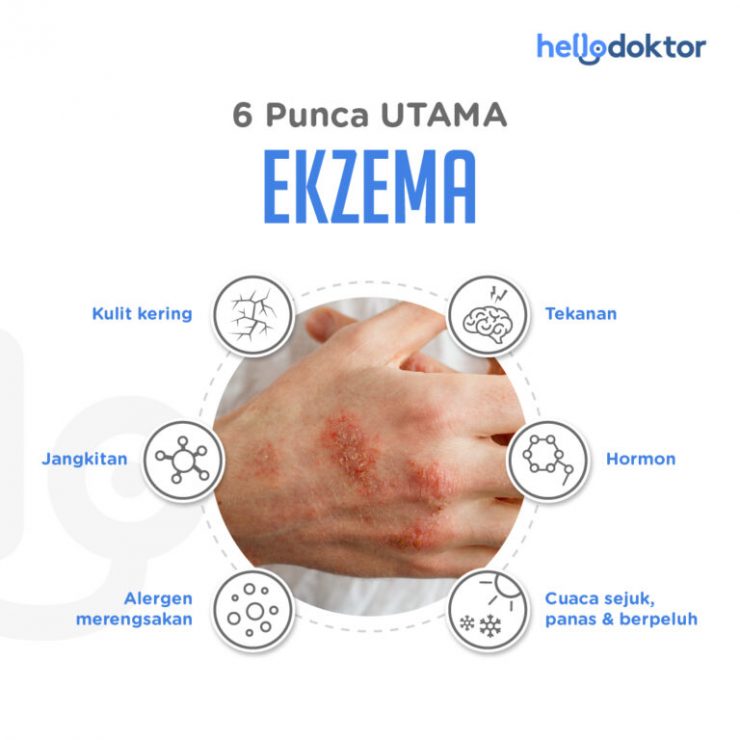 Penghidap Ekzema Perlu Elak 5 Jenis Ikan Yang Gatal Dimakan Ini