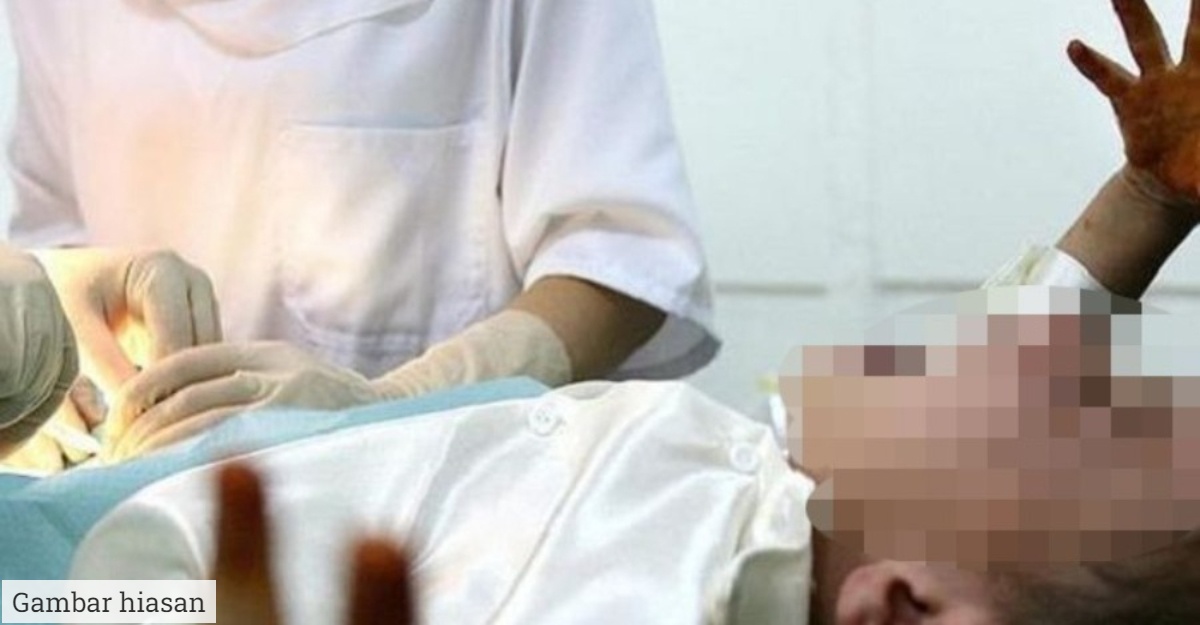 Doktor Terpotong 'Kepala' Kemaluan