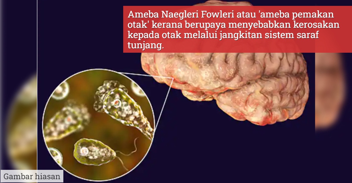 naegleria fowleri atau pemakan otak membawa maut