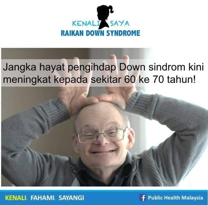 Negara Maju Dijangka Bebas Penyakit Sindrom Down
