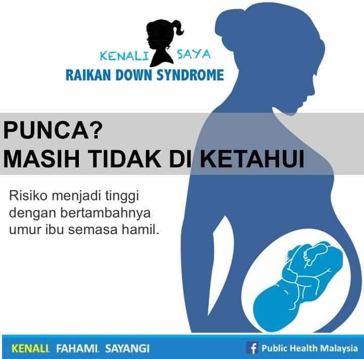 Negara Maju Dijangka Bebas Penyakit Sindrom Down