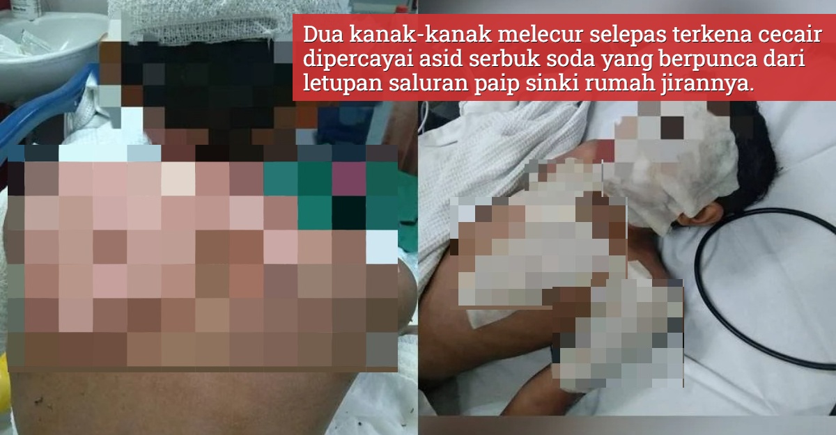 budak melecur sinki soda