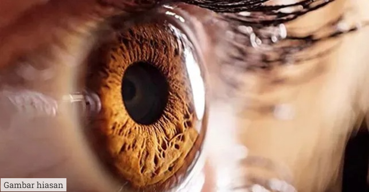 Nampak Bergerak Dalam Mata, Ketahui Apa Itu "Eye Floaters" & Puncanya
