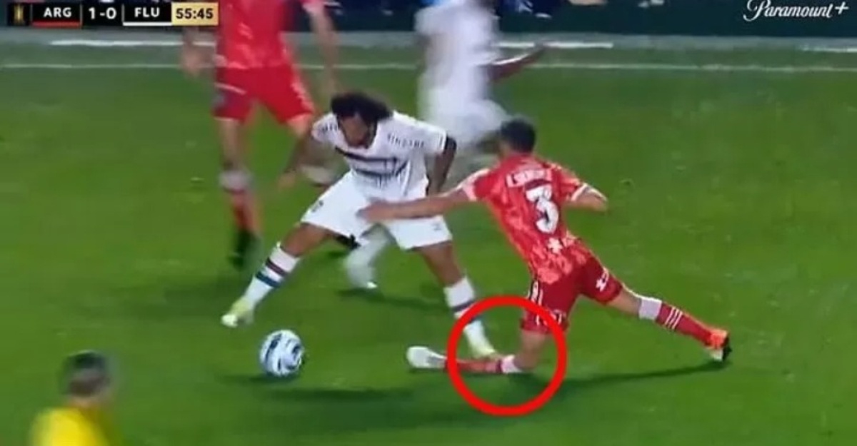 marcelo patahkan kaki