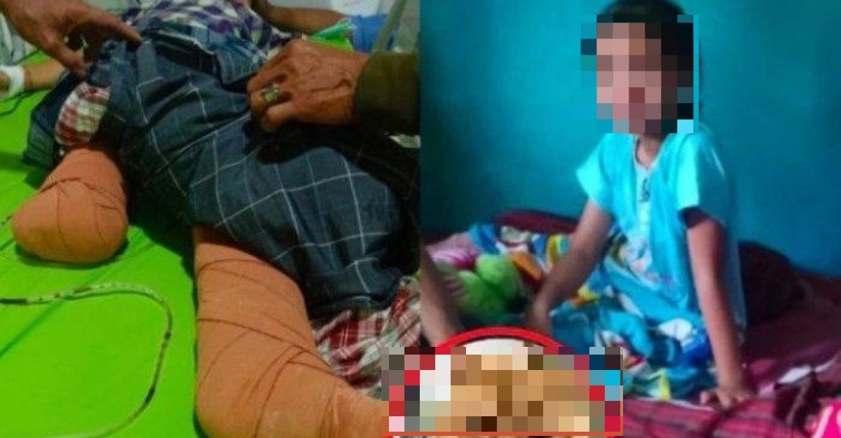 putus kaki digilis lori