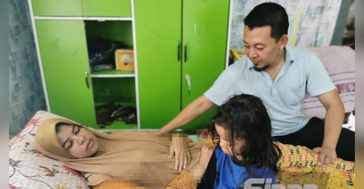 migrain ketumbuhan otak