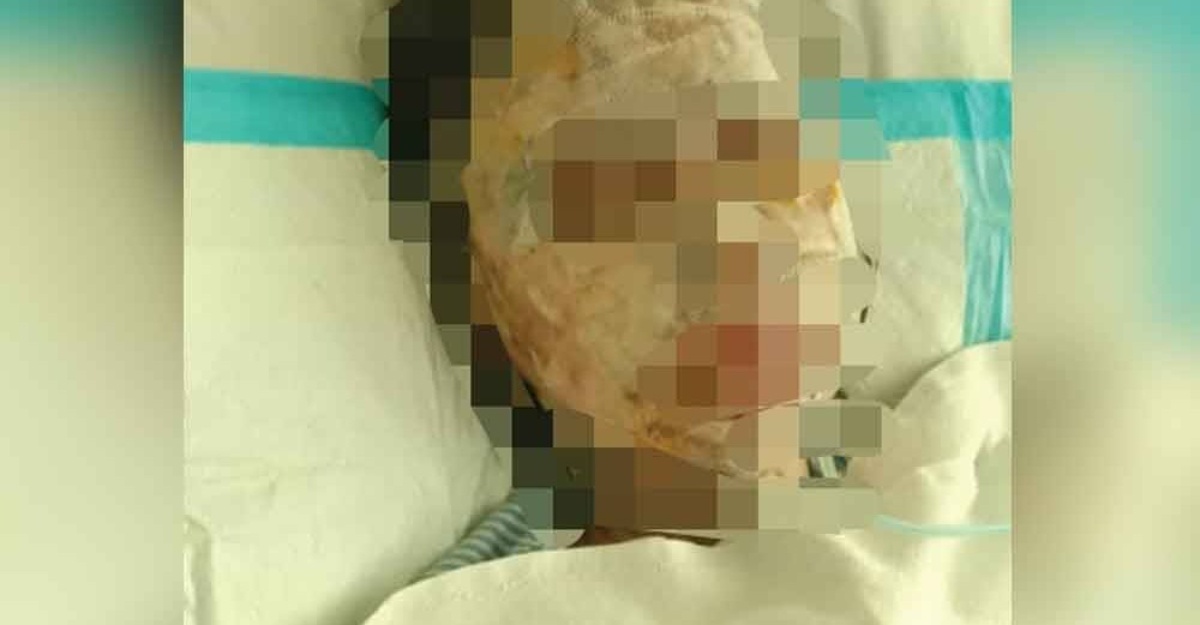 kes asid polis keterangan 12 individu
