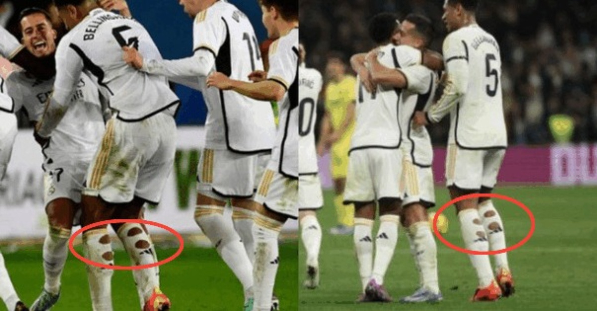 pemain bola stoking berlubang