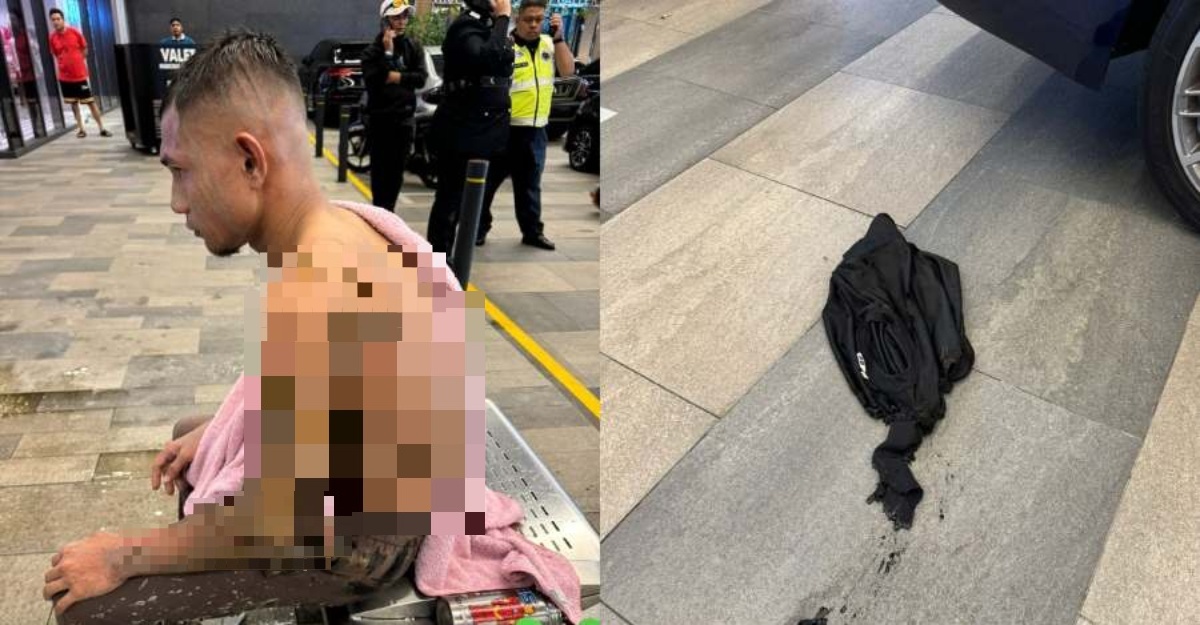 Faisal Halim Disimbah Asid