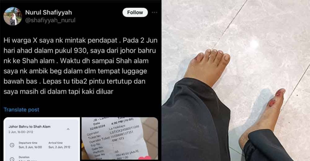 Kaki terseret terperangkap dalam bas
