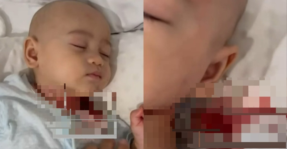 anak yana garu leher berdarah
