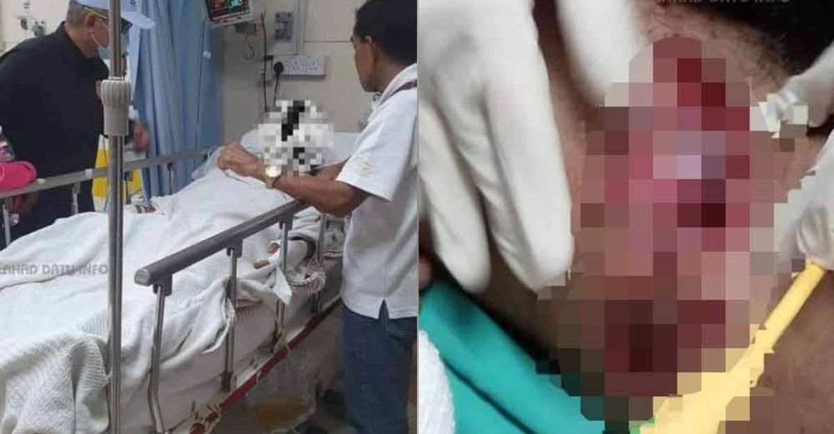 remaja tumbuk mata buaya