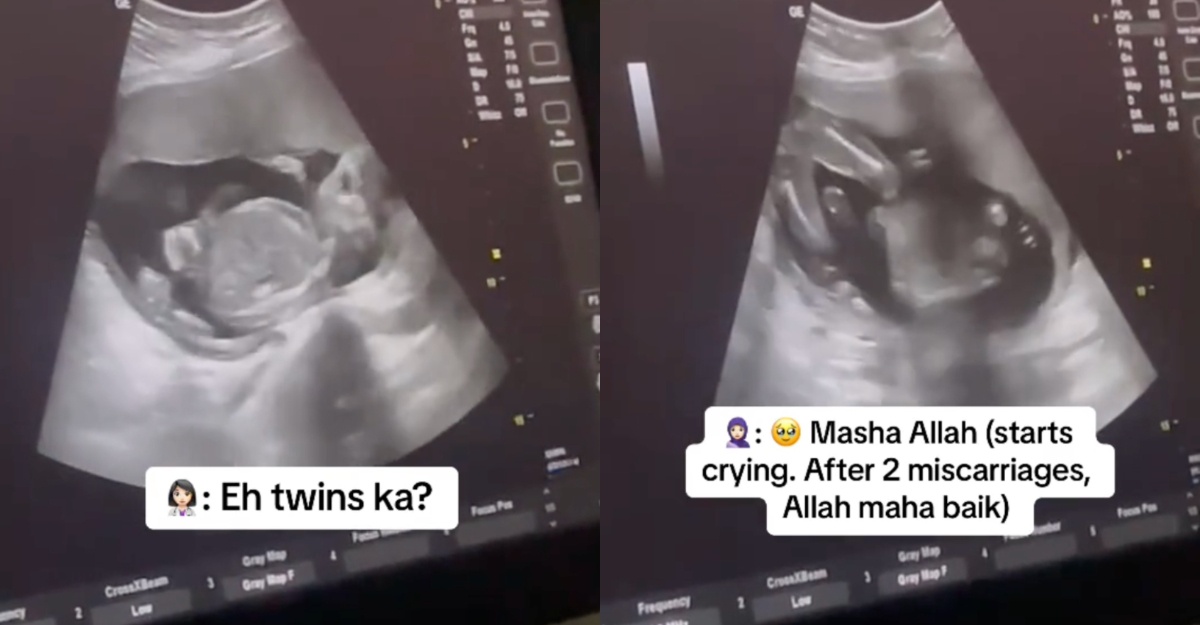 wanita hamil anak kembar