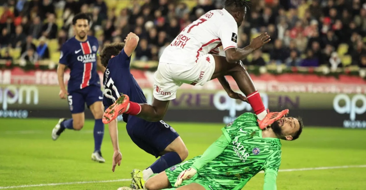 Donnarumma Terkena kaki monaco