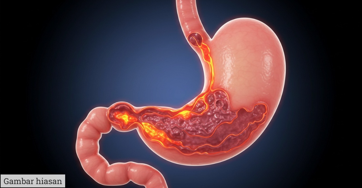 Tanda Gastrik Yang Ramai Tak Perasan: Kenali Gejala Awal
