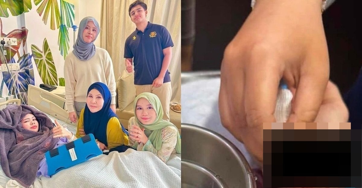 anak Bonda Rozita terkena mata pisau pengisar
