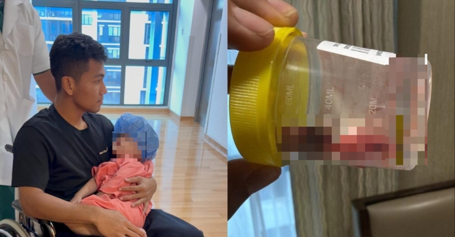 anak eyra hazali alami tonsil